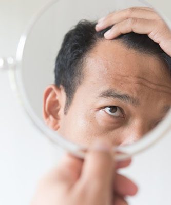 Hair-Transplant-Price-Malaysia